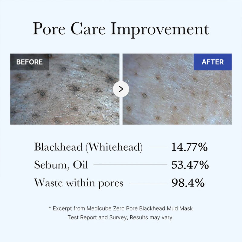 Nettoyage en profondeur des pores pour une peau visiblement sans points noirs